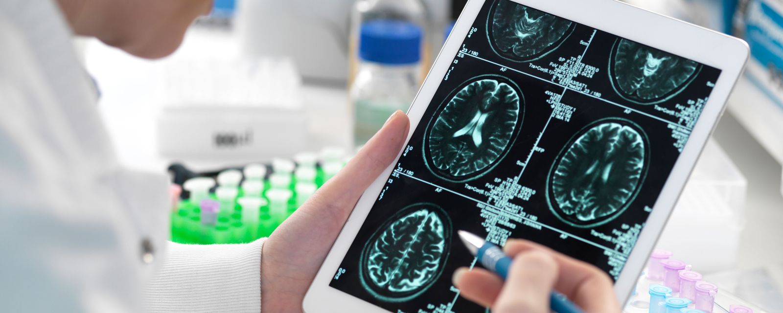 Arzt untersucht neurodegenerative Erkrankung