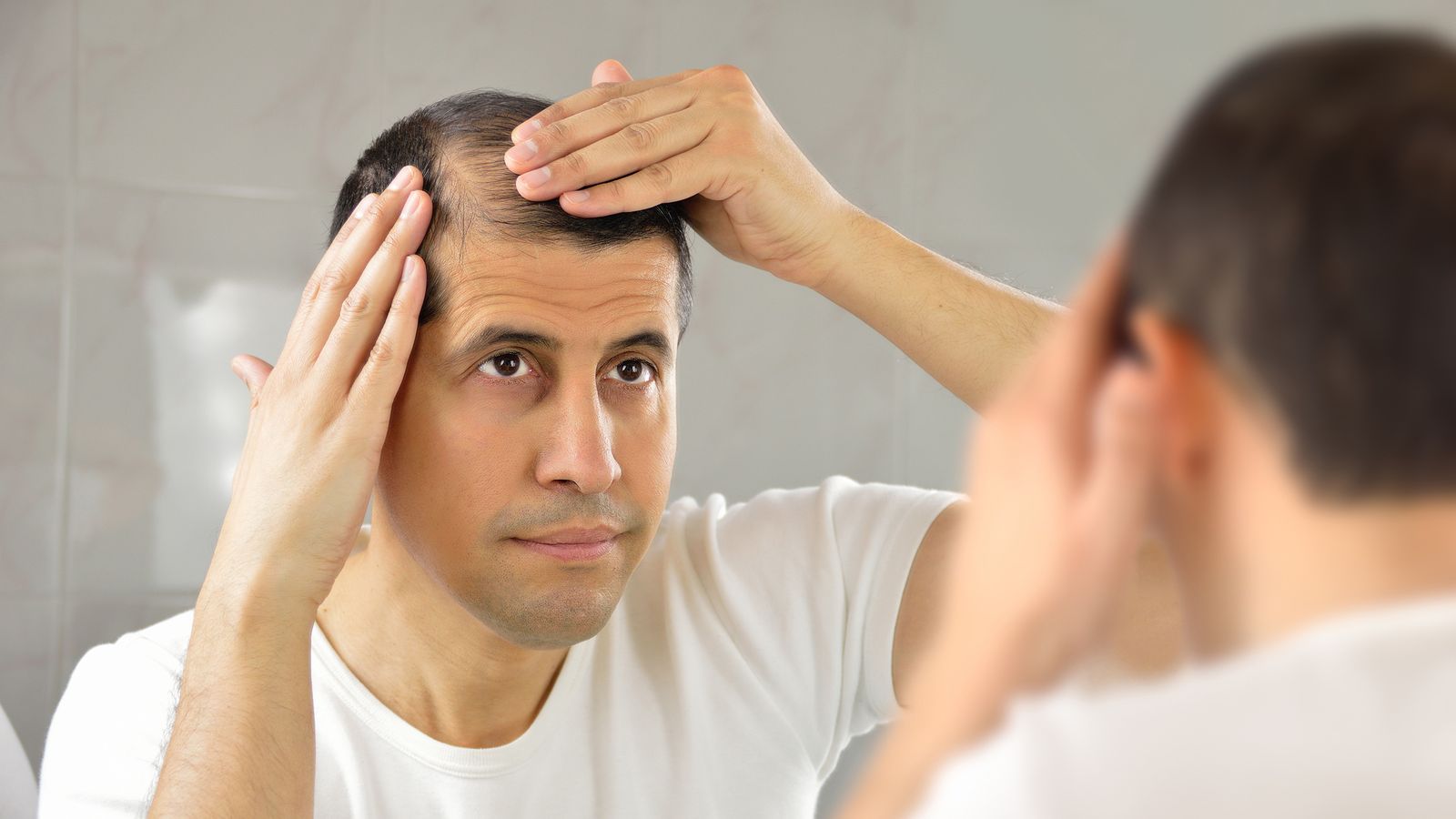 Vitaminmangel: Ursache von Haarausfall?