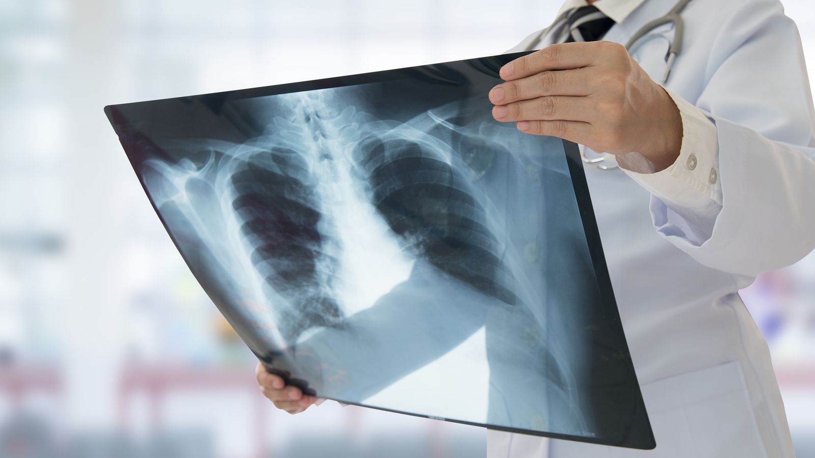 Arzt hält ein Röntgenbild in der Hand