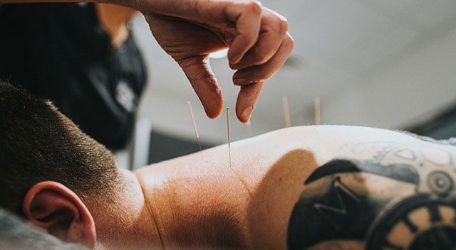Akupunktur kann die Therapie gegen Depressionen verbessern