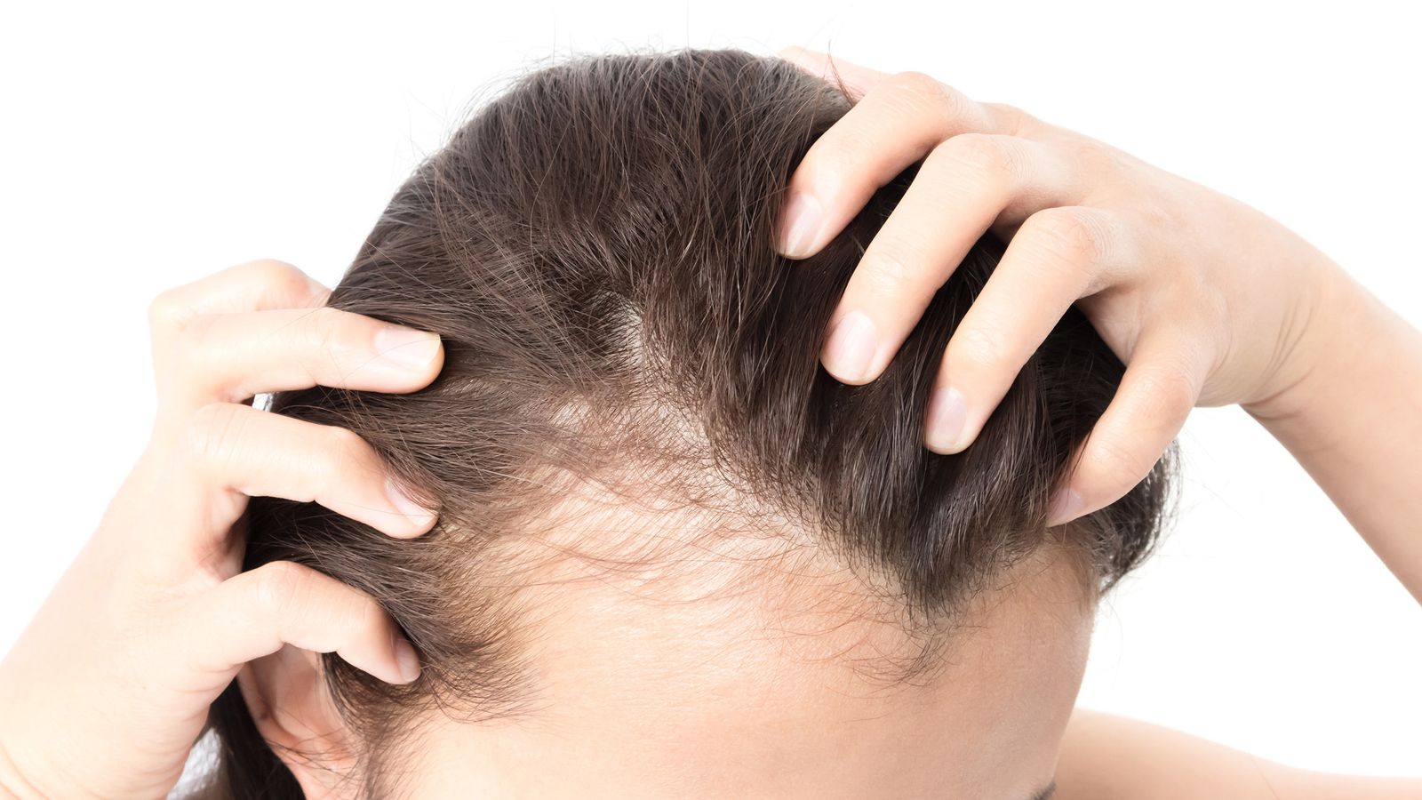 Dünnes Haar – Ursachen und Lösungen