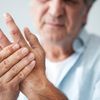 Arthritis Anzeichen