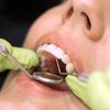 Zahnwurzelbehandlung bei einem Zahnarzt