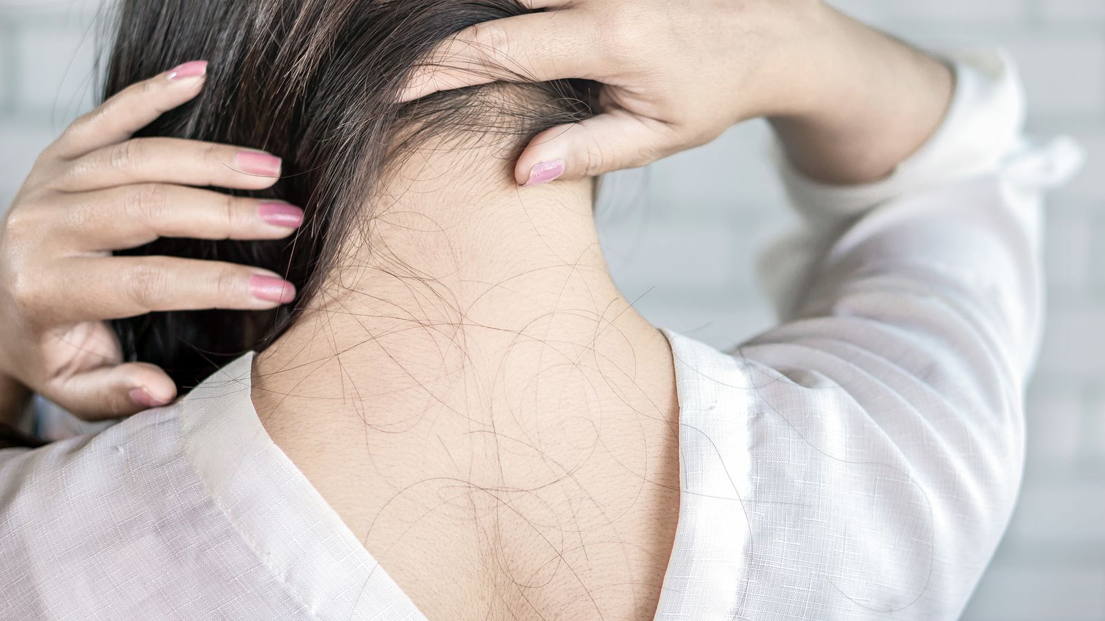 Diffuser Haarausfall bei einer Frau mit dunklen Haaren