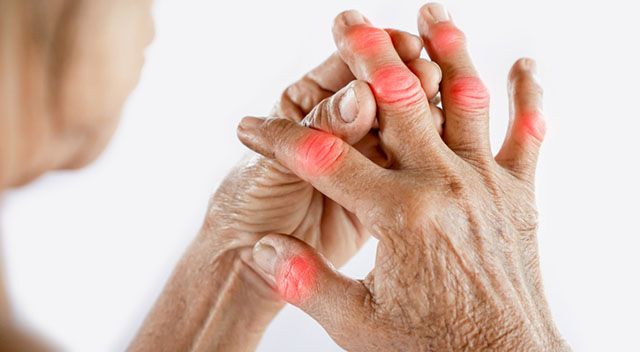 Frau mit Arthritis in den Fingern