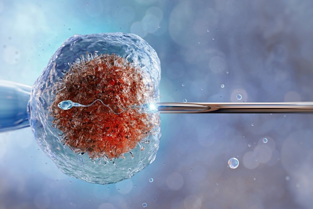 Künstliche Befruchtung beim Menschen, In-vitro-Fertilisation