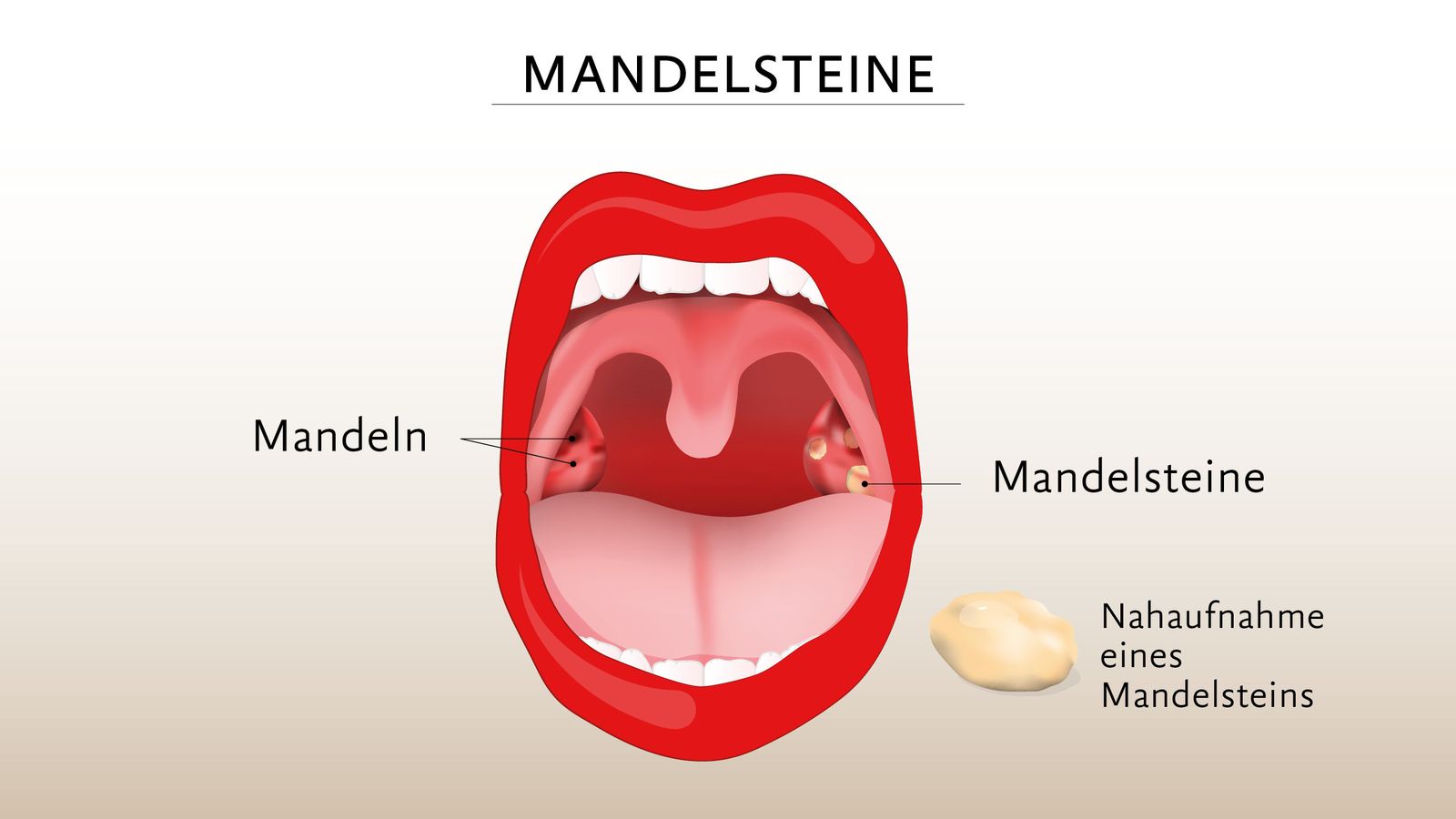 Mandeln und Mandelstein