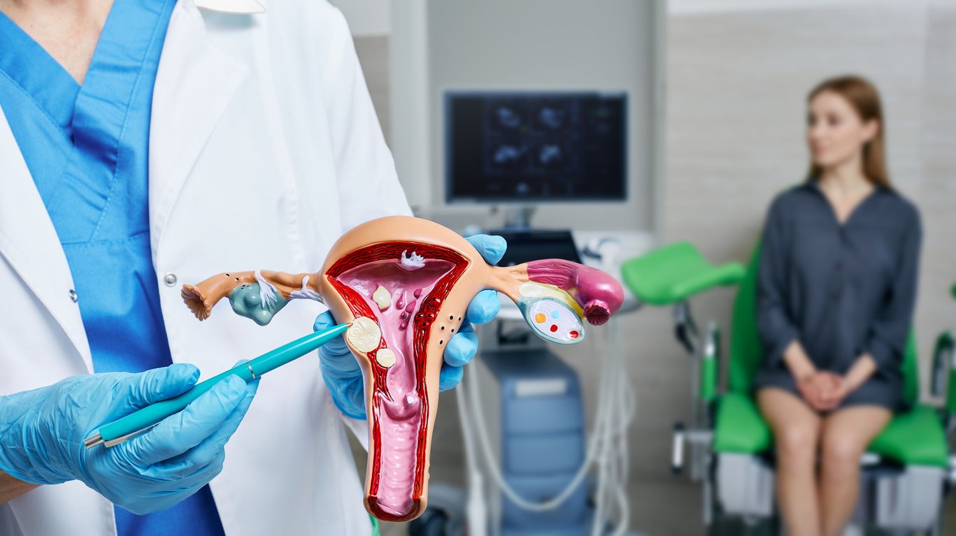 Gynäkologe zeigt Uterus-Leiomyome auf anatomisches Modell der Gebärmutter während der gynäkologischen Konsultation einer Patientin