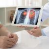 Arzt zeigt Röntgenbild mit Lungekrebs