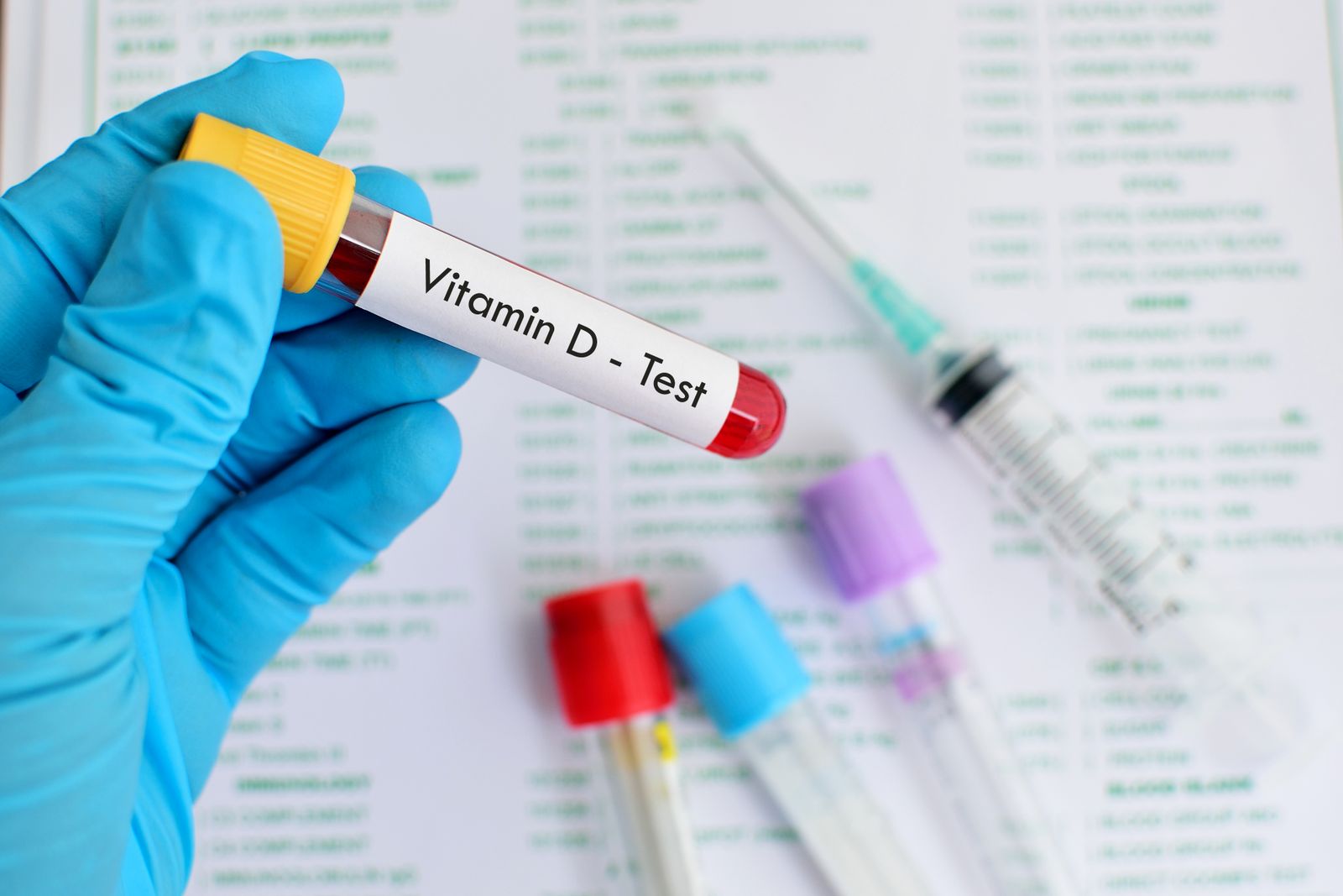 Vitamin-D-Spiegel wird mittels Blutentnahme überprüft